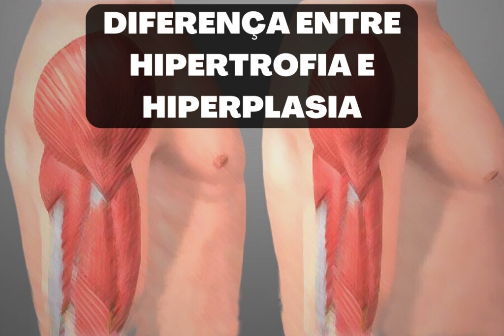 Entenda a Diferença entre Hipertrofia e Hiperplasia Diferença entre Hipertrofia e Hiperplasia
