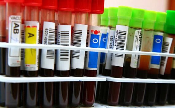 exames de sangue e DNA para determinar treino academia