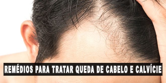 remédios para tratamento queda de cabelo e calvície